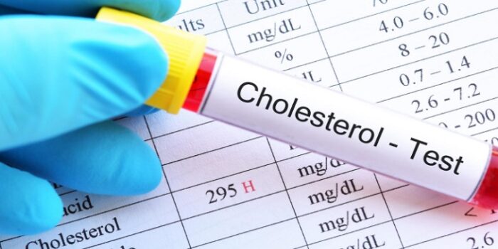 Nilai Kolesterol Normal Berdasarkan Usia dan Jenis Kelamin
