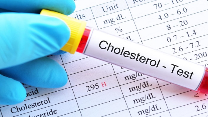 Nilai Kolesterol Normal Berdasarkan Usia dan Jenis Kelamin